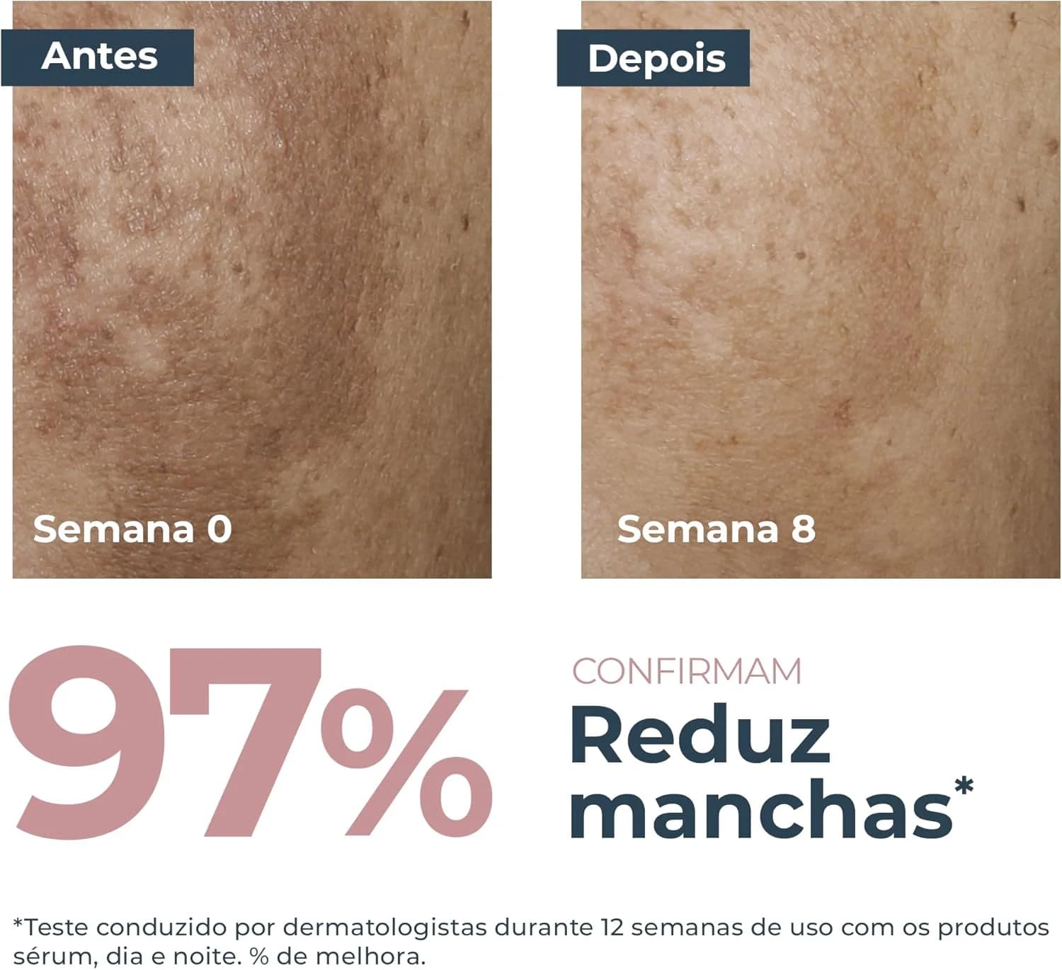 EUCERIN Dual Sérum Facial Antimanchas e Anti-idade 30ml