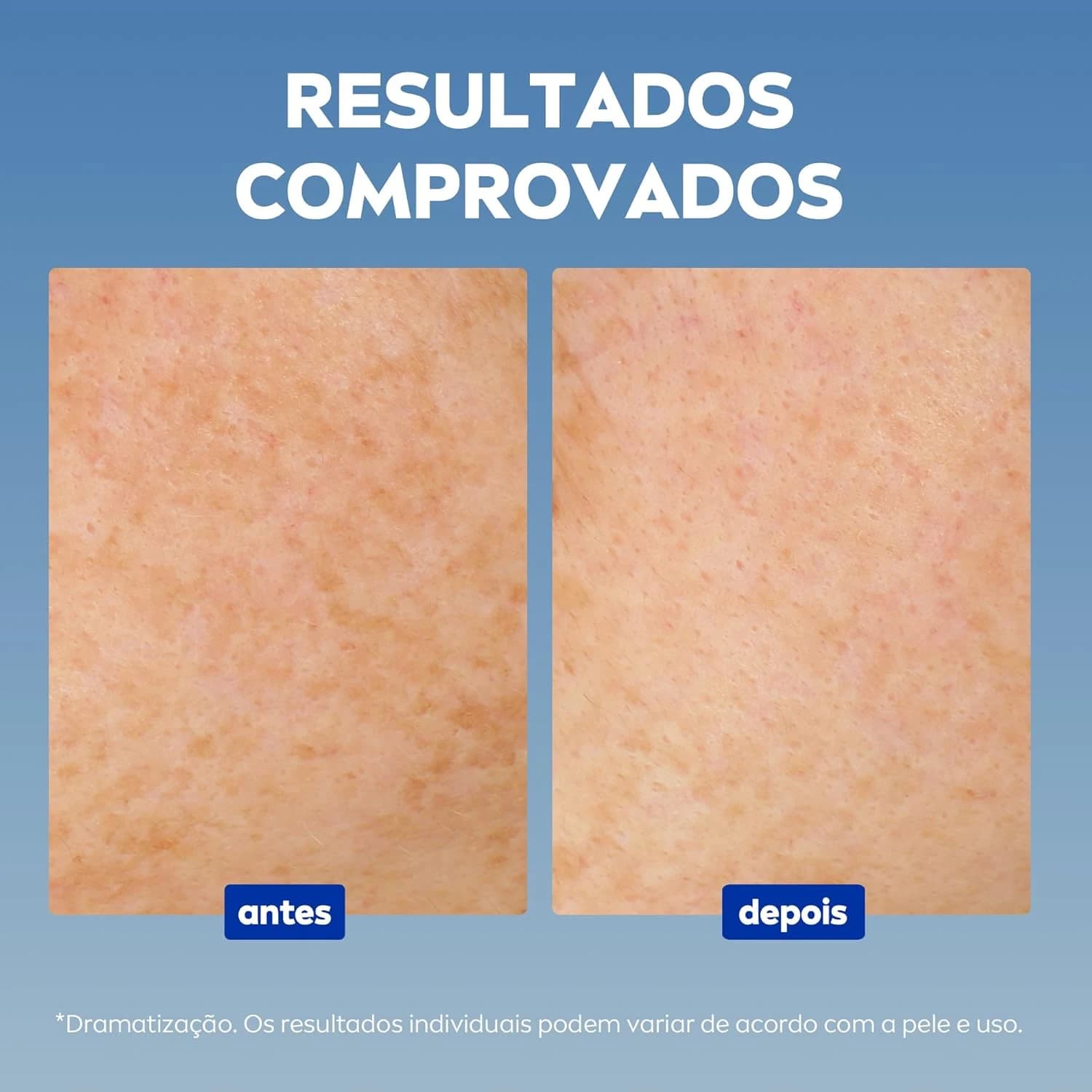 NIVEA Sérum Facial Cellular Luminous 630® ANTIMARCAS Anti-idade 30ml